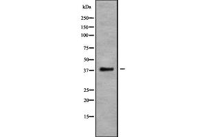 Western blot analysis of CCR10 using COLO205 whole cell lysates (CCR10 antibody  (C-Term))