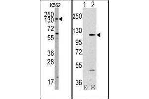 Image no. 1 for anti-Phosphoinositide-3-Kinase, Catalytic, alpha Polypeptide (PIK3CA) (Middle Region) antibody (ABIN360445) (PIK3CA antibody  (Middle Region))