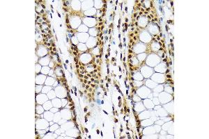 Immunohistochemistry of paraffin-embedded human colon using ML1BP Rabbit mAb (ABIN7268357) at dilution of 1:100 (40x lens). (MAD2L1BP antibody)