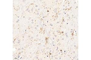 Immunohistochemistry of paraffin embedded mouse brain using P2Y12 (ABIN7075321) at dilution of 1: 1400 (400x lens) (P2RY12 antibody)