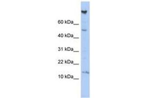 Image no. 1 for anti-NOTCH-Regulated Ankyrin Repeat Protein (NRARP) (AA 35-84) antibody (ABIN6743991) (NRARP antibody  (AA 35-84))
