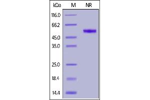 SDS-PAGE (SDS) image for CD70 Molecule (CD70) (AA 52-193) (Active) protein (DYKDDDDK Tag,His tag) (ABIN6952264)