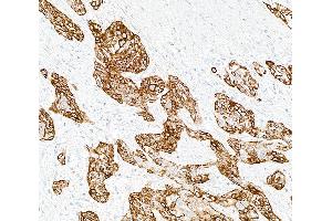 Immunohistochemistry (IHC) image for anti-Keratin 14 (KRT14) (C-Term) antibody (ABIN7795697)