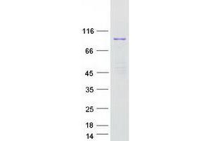 Validation with Western Blot