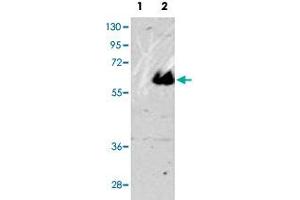 Western blot analysis of MAPT (arrow) using MAPT polyclonal antibody . (MAPT antibody  (C-Term))
