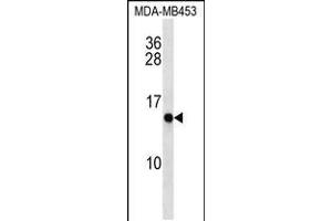 Western blot analysis MDA-MB453 cell line lysates (35ug/lane). (CRABP2 antibody  (C-Term))