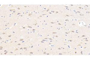 Detection of GnRH in Human Cerebrum Tissue using Polyclonal Antibody to Gonadotropin Releasing Hormone (GnRH) (GNRH1 antibody  (AA 24-92))