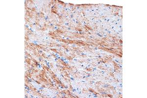 Immunohistochemistry of paraffin-embedded mouse heart using α-Actin-1  Rabbit mAb (ABIN1682816, ABIN7101454, ABIN7101455 and ABIN7101456) at dilution of 1:100 (40x lens).