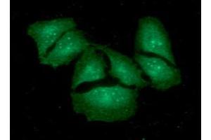 ICC/IF analysis of KCTD15 in HeLa cells. (KCTD15 antibody  (AA 1-159))