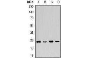 Western blot analysis of FGF14 expression in U937 (A), mouse brain (B), mouse spleen (C), rat brain (D) whole cell lysates. (FGF14 antibody)