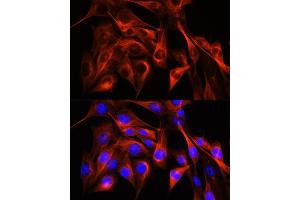 Immunofluorescence analysis of NIH-3T3 cells using α-Tubulin Rabbit pAb (ABIN3020549, ABIN3020550 and ABIN3020551) at dilution of 1:100 (40x lens).