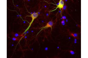 Indirect immunolabeling of PFA fixed rat hippocampus neurons with rabbit anti-Vti1a (dilution 1 : 500; red) and mouse anti-MAP 2 (cat. (VTI1A antibody)