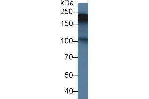 Western blot analysis of Rat Placenta lysate, using Rat TNC Antibody (1.