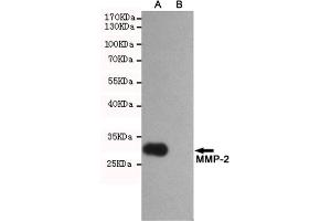Western blot analysis of extracts from CHO-K1 (B) and CHO-K1 transfected by P-2 fragment(A) cell lysates using P-2 mouse mAb (1:2000 diluted). (MMP2 antibody)