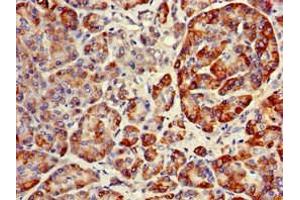 Immunohistochemistry of paraffin-embedded human pancreatic tissue using ABIN7151134 at dilution of 1:100 (RNF126 antibody  (AA 39-225))