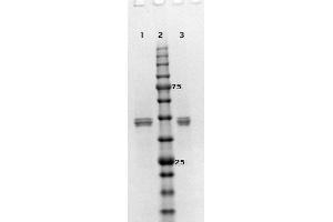 SDS-PAGE results of MEK2 Recombinant Protein. (MEK2 Protein)