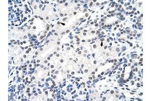 SURF6 antibody was used for immunohistochemistry at a concentration of 4-8 ug/ml to stain Epithelial cells of renal tubule (arrows) in Human Kidney.
