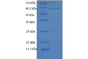 Galectin 6 (GAL6) (AA 1-301), (full length) protein (GST tag)