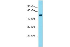 Host: Rabbit Target Name: MEX3A Sample Type: Fetal Brain lysates Antibody Dilution: 1. (MEX3A antibody  (N-Term))