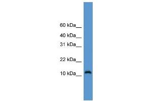 WB Suggested Anti-CDC26 Antibody Titration: 0. (CDC26 antibody  (Middle Region))