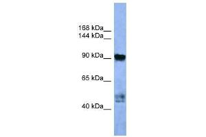 Western Blot showing AP2A2 antibody used at a concentration of 1-2 ug/ml to detect its target protein. (AP2A2 antibody  (C-Term))