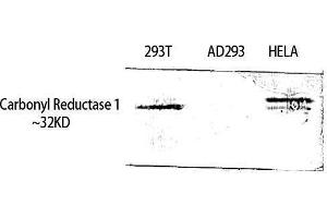 Western Blotting (WB) image for anti-Carbonyl Reductase 1 (CBR1) (Internal Region) antibody (ABIN3174160) (CBR1 antibody  (Internal Region))