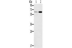 Western Blotting (WB) image for anti-Tumor Necrosis Factor Receptor Superfamily, Member 11a, NFKB Activator (TNFRSF11A) antibody (ABIN2827208) (TNFRSF11A antibody)