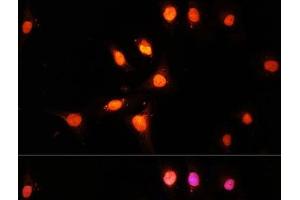 Immunofluorescence analysis of U-2 OS cells using KAT2A Polyclonal Antibody at dilution of 1:100 (40x lens). (KAT2A antibody)