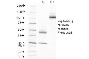 SDS-PAGE Analysis Purified MUC-1 Mouse Monoclonal Antibody (MUC1/845). (MUC1 antibody)