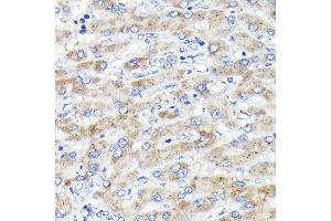 Immunohistochemistry of paraffin-embedded human liver using Glucosylceramidase beta (Glucosylceramidase beta (GBA)) Rabbit mAb (ABIN7267407) at dilution of 1:100 (40x lens). (GBA antibody)