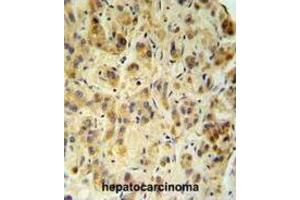 Immunohistochemistry (IHC) image for anti-Fucosidase, alpha-L- 1, Tissue (FUCA1) antibody (ABIN3002802) (FUCA1 antibody)