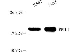Western blot analysis of PPIL1 (ABIN7075004),at dilution of 1: 800 (PPIL1 antibody)