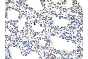 CSDC2 antibody was used for immunohistochemistry at a concentration of 4-8 ug/ml to stain Alveolar cells (arrows) in Human Lung. (CSDC2 antibody  (N-Term))