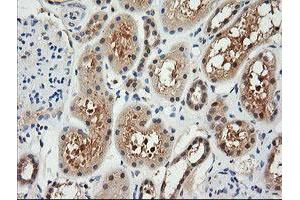 Image no. 1 for anti-Retinoic Acid Receptor Responder (Tazarotene Induced) 1 (RARRES1) antibody (ABIN1500601) (RARRES1 antibody)