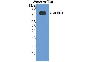 Western blot analysis of the recombinant protein. (VPS37A antibody  (AA 1-397))