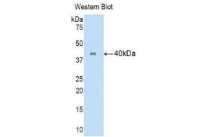 Western Blotting (WB) image for anti-Keratin 16 (KRT16) (AA 117-419) antibody (Biotin) (ABIN1172995) (KRT16 antibody  (AA 117-419) (Biotin))