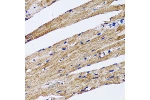 Immunohistochemistry of paraffin-embedded rat heart using MAP1LC3B antibody. (LC3B antibody)