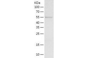 QPCTL Protein (AA 53-364) (His-IF2DI Tag)