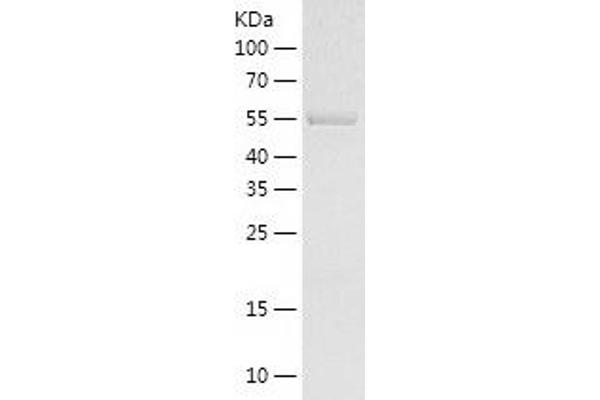 QPCTL Protein (AA 53-364) (His-IF2DI Tag)