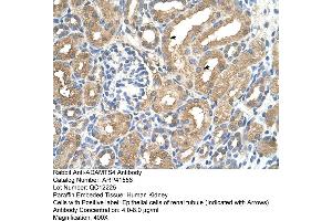 Rabbit Anti-ADAMTS4 Antibody  Paraffin Embedded Tissue: Human Kidney Cellular Data: Epithelial cells of renal tubule Antibody Concentration: 4. (ADAMTS4 antibody  (N-Term))