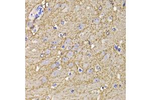 Immunohistochemistry of paraffin-embedded mouse brain using KCND3 antibody at dilution of 1:100 (x400 lens).