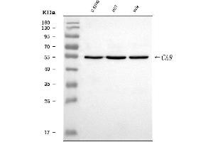 Western blot analysis of Carbonic Anhydrase 9/CA9 using anti-Carbonic Anhydrase 9/CA9 antibody (ABIN7600076).