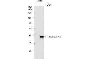 WB Image Doublecortin antibody detects Doublecortin protein by western blot analysis. (Doublecortin antibody)