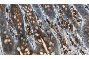 ABIN6276019 at 1/100 staining Mouse intestine tissue by IHC-P. (GPR158 antibody  (N-Term))