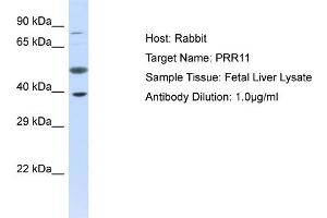 Host: Rabbit Target Name: PRR11 Sample Type: Fetal Liver lysates Antibody Dilution: 1. (PRR11 antibody  (C-Term))