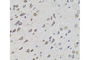 Immunohistochemistry of paraffin-embedded Rat brain using FoxO3a Polyclonal Antibody at dilution of 1:100 (40x lens). (FOXO3 antibody)