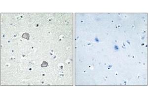 Immunohistochemistry analysis of paraffin-embedded human brain tissue, using EDG2 Antibody. (BUD31 antibody  (AA 5-54))