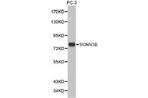 Western blot analysis of extracts of PC-3 cell lines, using SCNN1B antibody. (SCNN1B antibody  (AA 406-640))