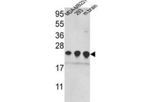 Western Blotting (WB) image for anti-Peroxiredoxin 2 (PRDX2) antibody (ABIN3001720)
