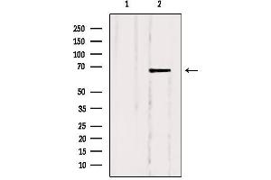 Western blot analysis of extracts from Hela, using SLC5A6 Antibody. (SLC5A6 antibody  (C-Term))